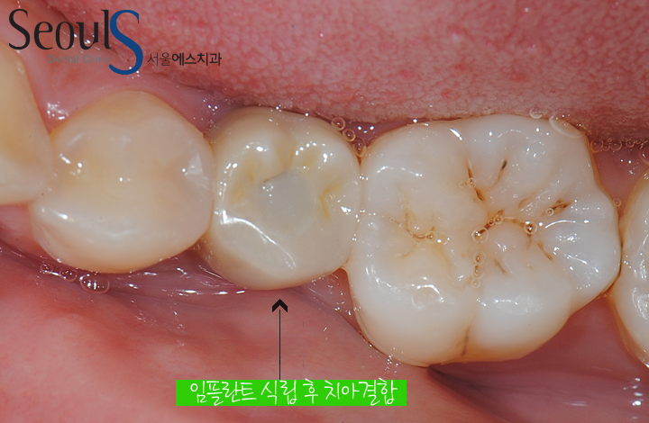 더블클릭을 하시면 이미지를 수정할 수 있습니다